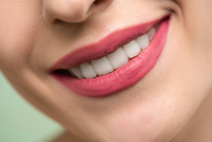 After: straight, confident smile