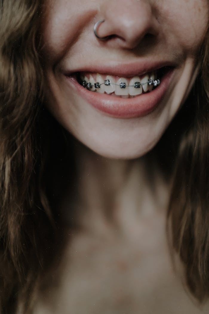 Before: teeth with orthodontic braces