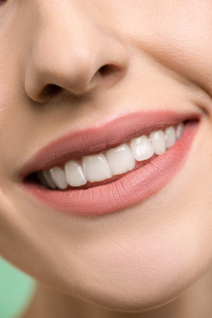After: bright, whitened smile